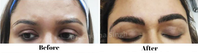 Microblading Eyebrows Treatment In Gurgaon